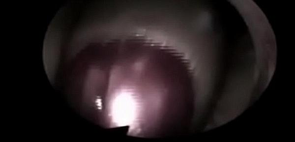  Video internal vagina